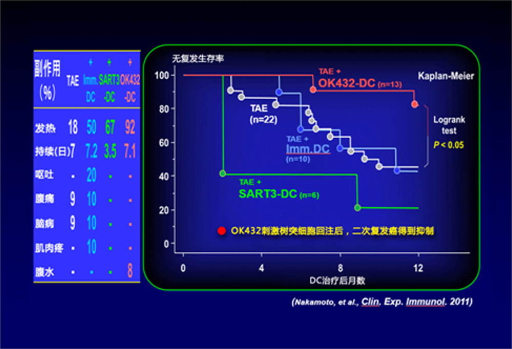 肝动脉栓塞术联合树突状细胞疗法　安全性和治疗效果