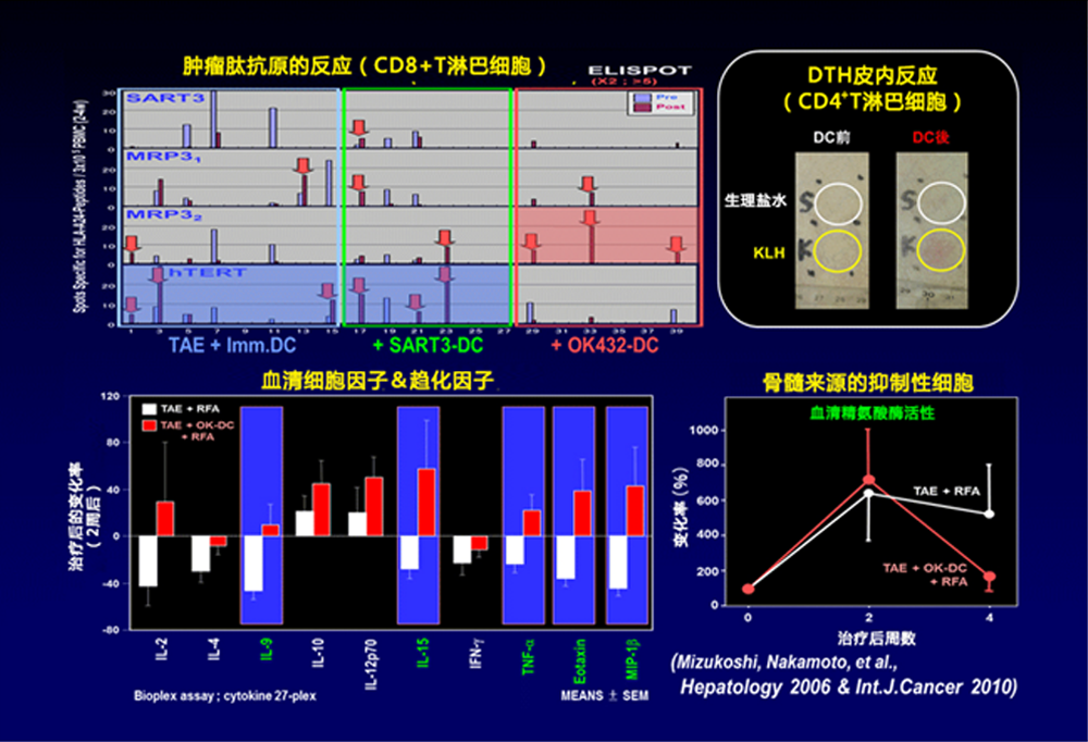 肝动脉栓塞书和联合树突状细胞疗法　作用机理