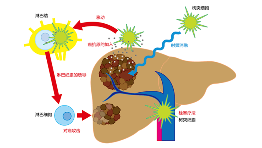 树突状细胞免疫疗法临床试验